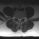 엠알아이 이미지