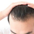 분당맥스웰의원 | 탈모 치료 병원 추천 TOP 5: 믿고 맡길 수 있는 곳은?