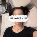서울마디시원신경과의원 | 미라젠의원 2️⃣회차| 리라젠소노, 프로토픽 연고 추가