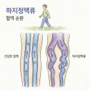 하지정맥류 베나실 수술 후기와 원인, 비용, 통증, 실비보험 청구까지