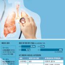 &#39;치료 무기&#39; 많아진 폐암… 4기암 생존 기간 5배 2019.10.15 이미지
