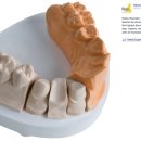 화인덴탈 이미지