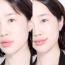 탄력앰플 추천 퓌라 펩타이드10 리버스세럼으로 셀프 안티에이징 피부관리 후기