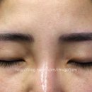 선이고운의원 이미지