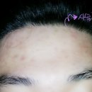 예손헤어라인 이미지