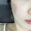 칠곡지 | 대구 북구 피부관리 로덱스화장품칠곡지사ㅣ 로덱스화장품 체험 후기