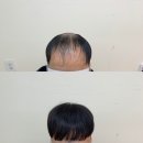 우정동미용실&wig 네이버블로그