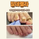 닥터아이티엔챈네일