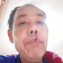 장 이용소 이미지