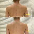 부산마르지아클리닉 덕천피부관리/ 본식 전 필수 바디관리 후기 &#39;브이오미에스테틱&#39;
