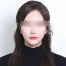 아이루미성형외과의원 | 아이루미성형외과 / 내돈내산 4번째 코재수술 후기