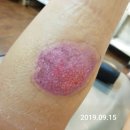 심재한의원 | 3도화상(또는 심재2도) 종아리 화상후기2-자연재생한의원 입원중 후기