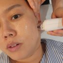 은성약국 | 울산 동구 에스테틱 뿌띠뜨뷰티샵 플라즈마 관리