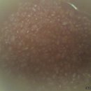 옹심이팥죽 이미지