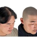 탈모왕 광주점 이미지