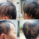 이종원내과의원 | 문재인 더불어 민주당 백신 부작용