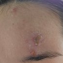 국홍일국정표피부과의원 이미지