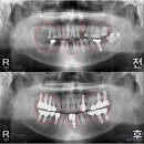 수플러스치과기공소 이미지