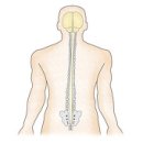 다발신경병증 이미지