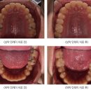 수정치과기공소 이미지