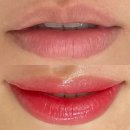 키아라강남 | 서울 청담 입술반영구문신 틴트립 키아라강남 1개월차 후기(탈각, 붓기, 리터치 후기)