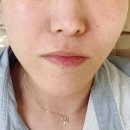 참피부과 | 콜라겐 스킨부스터 스컬트라 고민되면 올리디아 추천 가격 효과 압구정 피부과 시술 후기