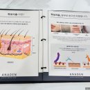 아나덴슈가링왁싱 길동역점 네이버블로그