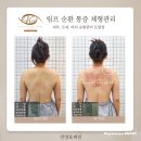 뷰스킨&숲칼프안양 | 안양피부관리 뷰스킨숲칼프 열돔 등관리 후기