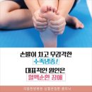 손발이찬이유 수족냉증에 대해 알아보자 이미지