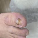 레푸스감삼점&에이레네
