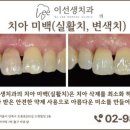이선생 치과의원 네이버블로그