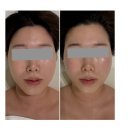 에토스 에스테틱 | 청주 에스테틱 청주경락추천 가경동 에토스 에스테틱 / 경락맛집 작은얼굴 중안부길이