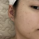 씨유에코시티점 | 전주피부관리 에코시티 더맑은스킨에서 화이트태닝&amp;플라즈마 받은 후기