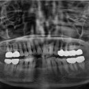 열린오치과의원 이미지