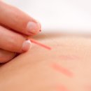 두꺼비 한의원 이미지