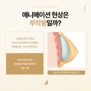 조이플성형외과의원 이미지