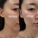 대림1 태양광 | 대림역 피부관리샵 추천 [MJ뷰티] 프리미엄 광 미백 후기 (주차/위치/가격 정보)