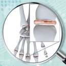 서울아산바른의원 이미지