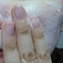 엔에프(주) | 피지 제거부터 히알루론산 보습까지, 환절기 트러블 피부 4단계 루틴