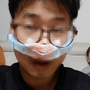 지에스25 봉담엘타워점 | 코 골절 수술-1[비관혈적 정복술]