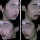 단디단디 | 일산예비신부관리 안면비대칭교정14회차, 웨딩케어 추천