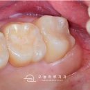 현대치과산업 이미지