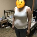 티바이오 | 자보티바 관리 실제 후기와 변화