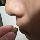 요산 | [통풍] 제로풍 통풍 완화 경험 후기 – 요산수치억제 &amp; 통풍치료제 고민 끝!