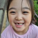 유치 빼기/ 사랑이 누나 첫니가 빠졌습니다~
