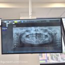 조은이네 | 치과정기검진 / 불소도포 -경기 양주 치과 추천 [조은이플란트 치과의원] 어린이 치과/소아치과/ 위치...