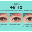 골드눈썹 이미지