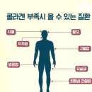 구강점막에 붙이는 콜라겐 필름 이미지