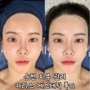 카리스 | 순천 피부 관리 카리스 에스테틱 뷰티포딕스 후기
