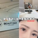 울산비비성형외과의원 | 신사역 뷰티바에서 쌍커플필러 저도 했어요!